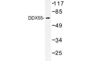 Image no. 1 for anti-DEAD (Asp-Glu-Ala-Asp) Box Polypeptide 55 (DDX55) antibody (ABIN317819) (DDX55 抗体)