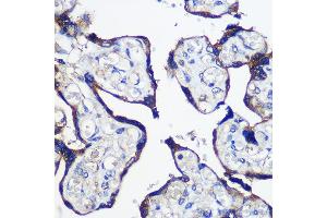Immunohistochemistry of paraffin-embedded Human placenta using P Rabbit pAb (ABIN6133216, ABIN6145242, ABIN6145243 and ABIN6216694) at dilution of 1:100 (40x lens). (PARP8 抗体  (AA 1-300))