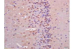 Formalin-fixed and paraffin embedded rat brain labeled with Anti-IGFBP9 Polyclonal Antibody, Unconjugated (ABIN761816) at 1:200 followed by conjugation to the secondary antibody and DAB staining (NOV 抗体  (AA 221-320))