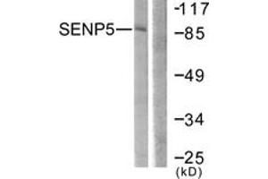 Western blot analysis of extracts from COS7 cells, using SENP5 Antibody. (SENP5 抗体  (AA 651-700))