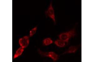 ABIN6274802 staining Hela cells by IF/ICC. (ACTR3 抗体  (C-Term))