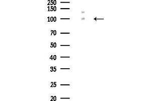 Western blot analysis of lysates from COLO205 cells(UV,30 min treatment), using EPH Antibody at 1/1000 dilution.