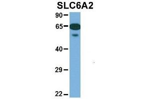 Western Blotting (WB) image for anti-Solute Carrier Family 6 (Neurotransmitter Transporter, Noradrenalin), Member 2 (SLC6A2) (Middle Region) antibody (ABIN2777051)
