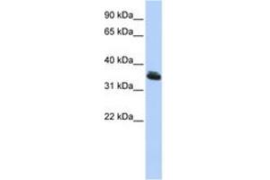 Image no. 1 for anti-LIM Homeobox 3 (LHX3) (C-Term) antibody (ABIN6742273) (LHX3 抗体  (C-Term))
