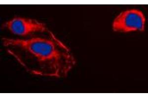 Immunofluorescent analysis of RKIP staining in HepG2 cells. (PEBP1 抗体  (Center))