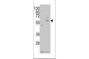 Western blot analysis of AT(Slc29a4) (arrow) using rabbit polyclonal AT(Slc29a4) Antibody (C-term) (ABIN387944 and ABIN2844505). (SLC29A4 抗体  (AA 452-481))