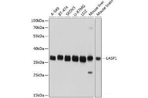 Western blot analysis of extracts of various cell lines using LASP1 Polyclonal Antibody at dilution of 1:1000. (LASP1 抗体)