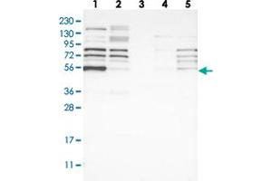 Western blot analysis of Lane 1: RT-4, Lane 2: U-251 MG, Lane 3: Human Plasma, Lane 4: Liver, Lane 5: Tonsil with WIPF2 polyclonal antibody  at 1:250-1:500 dilution. (WIPF2 抗体)