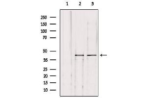Western blot analysis of extracts from various samples, using KITH_HHV1S Antibody. (HHV-1 Thymidine Kinase 抗体)