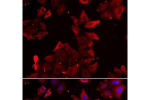 Immunofluorescence analysis of U2OS cells using PDLIM1 Polyclonal Antibody (PDLIM1 抗体)