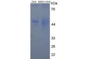 Image no. 3 for KiSS-1 Metastasis-Suppressor (KISS1) peptide (Ovalbumin) (ABIN5666260) (KiSS-1 Metastasis-Suppressor (KISS1) peptide (Ovalbumin))