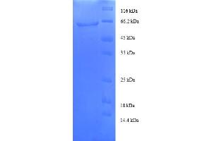 SDS-PAGE (SDS) image for Transaldolase 1 Pseudogene 1 (TALDO1P1) (AA 9-337), (partial) protein (GST tag) (ABIN5712345)