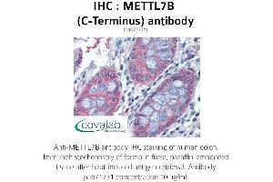 Image no. 1 for anti-Methyltransferase Like 7B (METTL7B) (C-Term) antibody (ABIN1736925) (METTL7B 抗体  (C-Term))