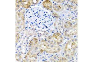 Immunohistochemistry of paraffin-embedded rat kidney using SULT1A1 antibody (ABIN5970776) at dilution of 1/100 (40x lens). (SULT1A1 抗体)