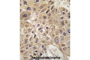 Immunohistochemistry (IHC) image for anti-Autocrine Motility Factor Receptor (AMFR) antibody (ABIN2995186) (AMFR 抗体)
