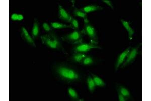 Immunofluorescence staining of Hela cells with ABIN7155673 at 1:66, counter-stained with DAPI. (DLX1 抗体  (AA 8-114))