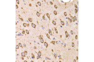 Immunohistochemistry of paraffin-embedded mouse brain using EEF1B2 Antibody.