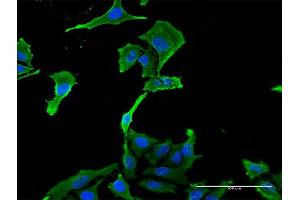 Immunofluorescence of monoclonal antibody to BNC1 on HeLa cell. (Basonuclin 1 抗体  (AA 599-705))