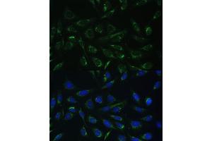 Immunofluorescence analysis of U-2 OS cells using HCCS Polyclonal Antibody (ABIN6129024, ABIN6141652, ABIN6141653 and ABIN6223386) at dilution of 1:100 (40x lens). (HCCS 抗体  (AA 1-268))