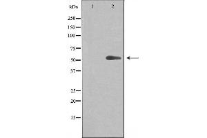 Western blot analysis of extracts from Jurkat cells, using Cytochrome P450 20A1 antibody. (CYP20A1 抗体  (Internal Region))