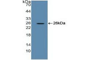 Figure. (EEF2 抗体  (AA 32-233))