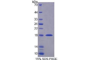 SDS-PAGE analysis of Human SNAPAP Protein. (SNAPIN 蛋白)