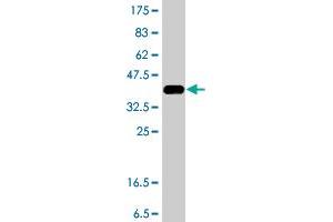 Western Blot detection against Immunogen (38. (AKR1C1 抗体  (AA 1-110))