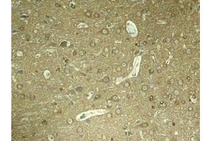 Immunohistochemical analysis of paraffin-embedded rat hippocampal region tissue from a model with Alzheimer (MAPT 抗体  (pSer404))