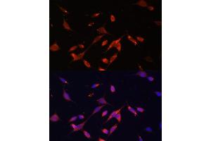 Immunofluorescence analysis of NIH/3T3 using PI3 Kinase p85 beta antibody (ABIN7269320) at dilution of 1:100. (PIK3R2 抗体)