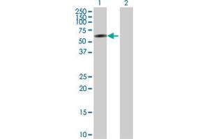 Western Blot analysis of IRF2 expression in transfected 293T cell line by IRF2 MaxPab polyclonal antibody. (IRF2 抗体  (AA 1-349))