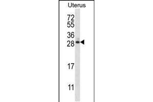 Western blot analysis in human normal Uterus tissue lysates (35ug/lane). (ARL8A 抗体  (AA 82-110))