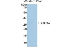 Western blot analysis of the recombinant protein. (PIM2 抗体  (AA 98-319))