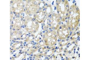 Immunohistochemistry of paraffin-embedded Mouse kidney using ST8SIA2 Polyclonal Antibody at dilution of 1:100 (40x lens). (ST8SIA2 抗体)