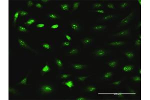Immunofluorescence of purified MaxPab antibody to RRS1 on HeLa cell. (RRS1 抗体  (AA 1-365))