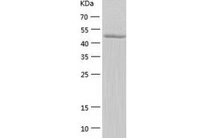 Western Blotting (WB) image for Hemopexin (HPX) (AA 24-460) protein (His tag) (ABIN7123298)