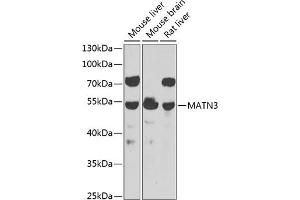 Western blot analysis of extracts of various cell lines, using M antibody  at 1:1000 dilution. (Matrilin 3 抗体  (AA 277-486))