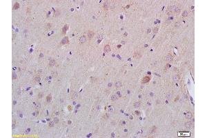 Formalin-fixed and paraffin embedded rat brain labeled with Rabbit Anti ZDHHC21 Polyclonal Antibody, Unconjugated (ABIN705566) at 1:200 followed by conjugation to the secondary antibody and DAB staining (ZDHHC21 抗体  (AA 131-240))