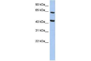 WB Suggested Anti-EFHA2 Antibody Titration: 0. (EFHA2 抗体  (N-Term))