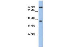 Image no. 1 for anti-Radial Spoke Head 10 Homolog B (RSPH10B) (AA 287-336) antibody (ABIN6743957) (RSPH10B 抗体  (AA 287-336))