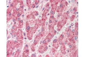Human, Liver: Formalin-Fixed Paraffin-Embedded (FFPE). (NUDC 抗体  (AA 124-173))