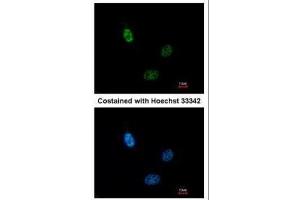 ICC/IF Image Immunofluorescence analysis of paraformaldehyde-fixed HeLa, using CLP1, antibody at 1:200 dilution.