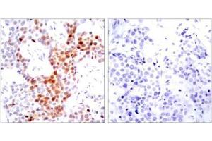 Image no. 1 for anti-Activating Transcription Factor 2 (ATF2) (pThr51), (pThr69) antibody (ABIN196664) (ATF2 抗体  (pThr51, pThr69))