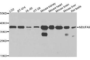 Western blot analysis of extracts of various cell lines, using NDUFA9 antibody (ABIN5971643) at 1/1000 dilution. (NDUFA9 抗体)