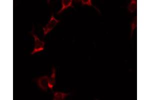 ABIN6274850 staining HeLa by IF/ICC. (Annexin a10 抗体  (N-Term))