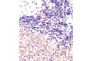 (ABIN6242141 and ABIN6578005) staining (Mouse) Suz12 in mouse spleen sections by Immunohistochemistry (IHC-P - paraformaldehyde-fixed, paraffin-embedded sections). (SUZ12 抗体  (AA 381-395))