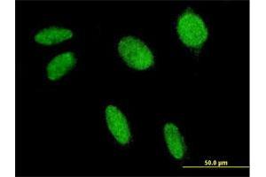 Immunofluorescence of monoclonal antibody to FLI1 on HeLa cell. (FLI1 抗体  (AA 1-452))