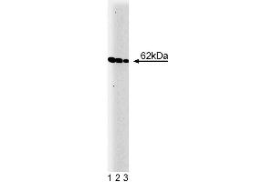 Western blot analysis of Yes on a A431 cell lysate (Human epithelial carcinoma, ATCC CRL-1555). (YES1 抗体  (AA 10-193))