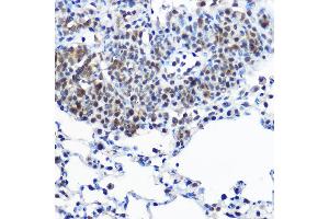 Immunohistochemistry of paraffin-embedded rat lung using Casein Kinase 2 beta (Casein Kinase 2 beta (CSNK2B)) Rabbit pAb  at dilution of 1:100 (40x lens). (CSNK2B 抗体  (AA 1-215))