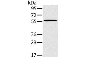 Western Blot analysis of Jurkat cell using TRIM34 Polyclonal Antibody at dilution of 1:250 (TRIM34 抗体)