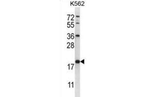Western Blotting (WB) image for anti-Glutathione S-Transferase mu 5 (GSTM5) antibody (ABIN2996912) (GSTM5 抗体)